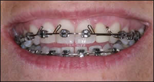 Comprehensive Care Figure 6 Comprehensive Care Figure 6