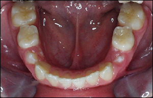Dentofacial Orthopaedic Dentofacial Orthopaedic