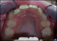 Dentofacial Orthopaedic Dentofacial Orthopaedic