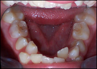 dentofacial orthopaedic dentofacial orthopaedic