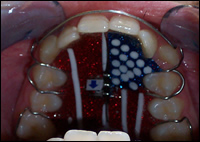 Dentofacial Dentofacial