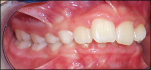 twin block twin block