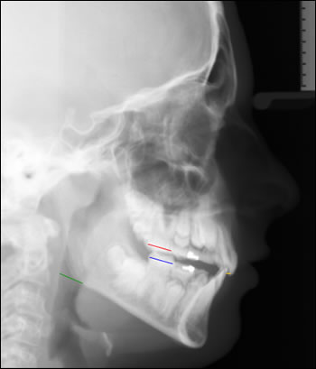 dentofacial dentofacial