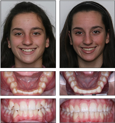 Orthodontics
