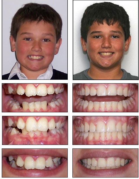 Orthodontics