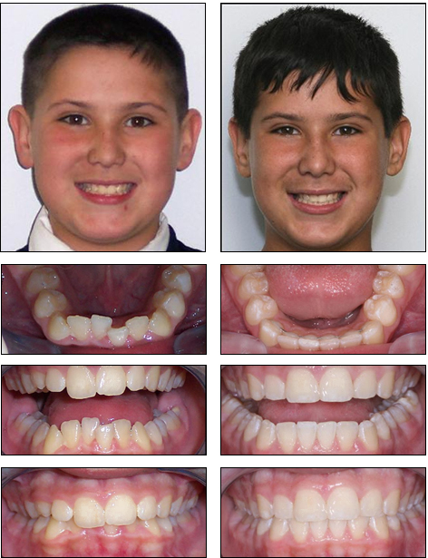 Orthodontics