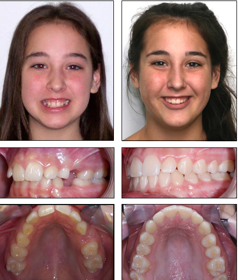 Orthodontics