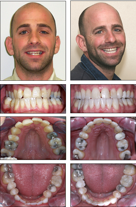 cs orthodontics