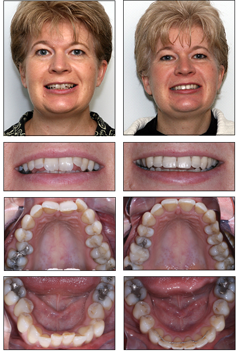 cs orthodontics