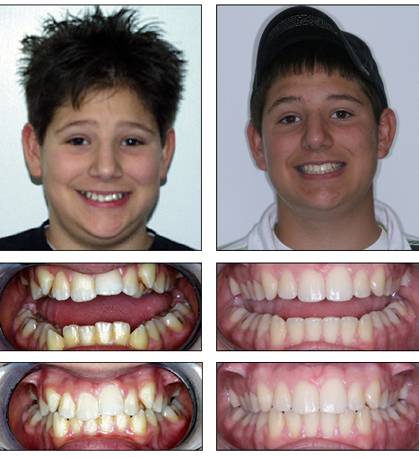 Orthodontics