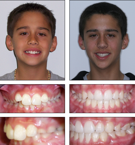 Orthodontics