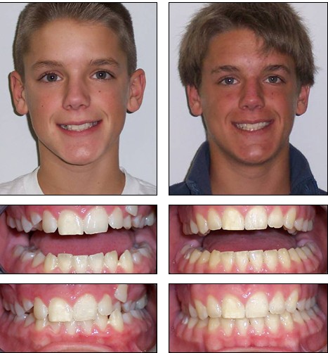 Orthodontics