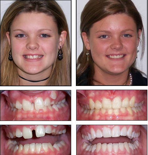 Orthodontics